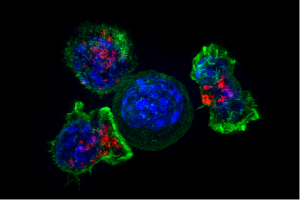 A group of CD8+ T cells (green and red) surrounding a cancer cell (blue, center). 