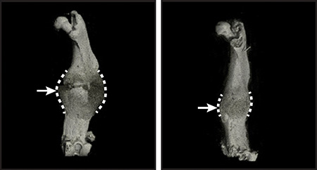 Compared to healthy mice (left), the leg bones of mice lacking biglycan (right) formed smaller protective calluses, indicated by arrows at fracture sites. 
