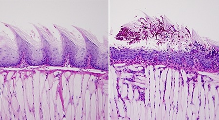 Compared to healthy mice (left), the protective barrier of tissue on the surface of the tongue in mice with APECED-like disease (right) developed Candida infection. 