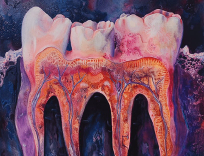 Watercolor painting esque image of the molars and roots with the purple gums/backdrop