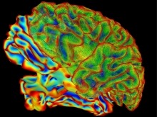 Colorful brain scan of individual, part of the mysterious BRAIN Initiative.