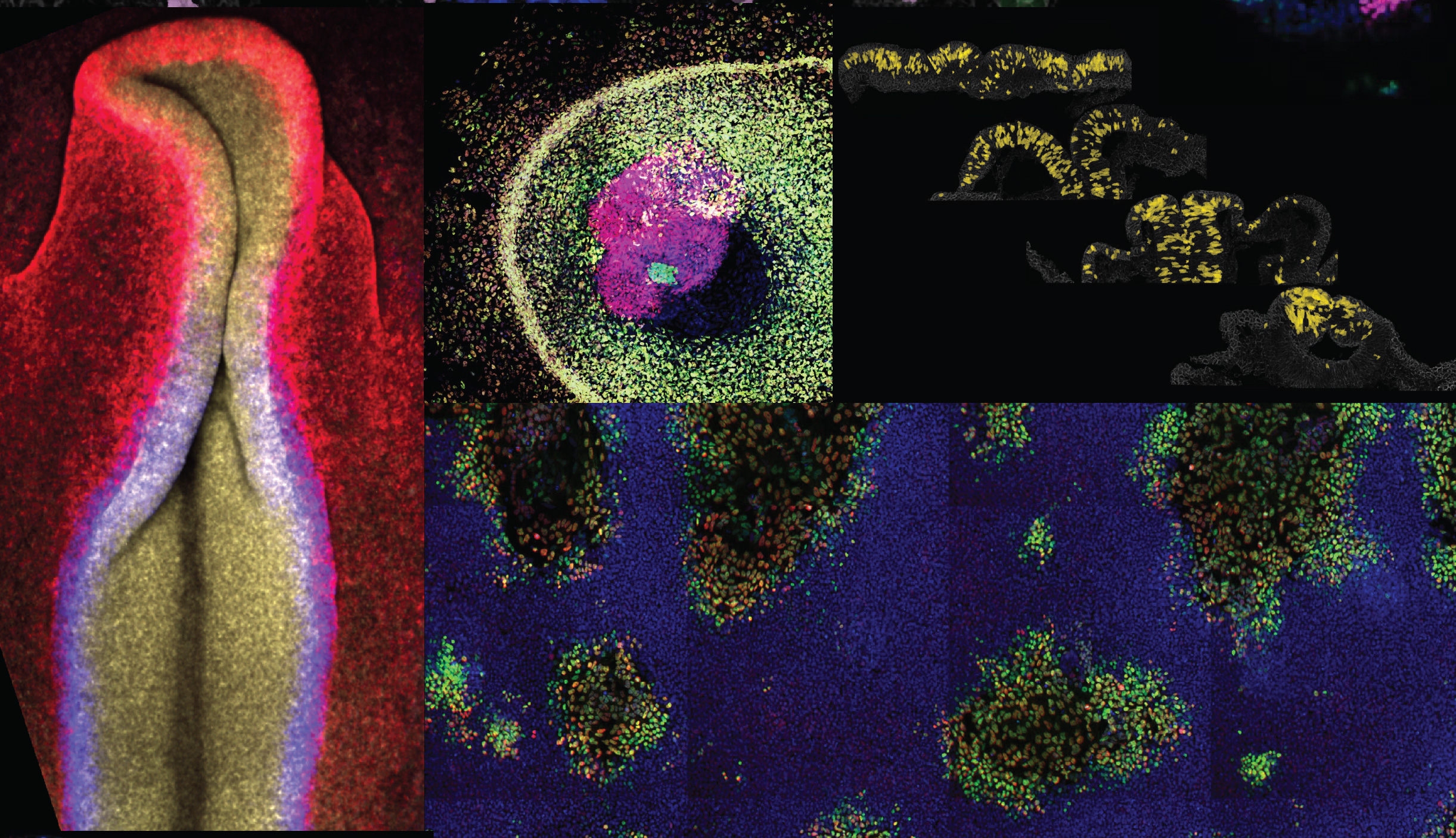 Examples of fluorescent and pseudo-colored images of developing neural crest cells in the embryo and in tissue culture.