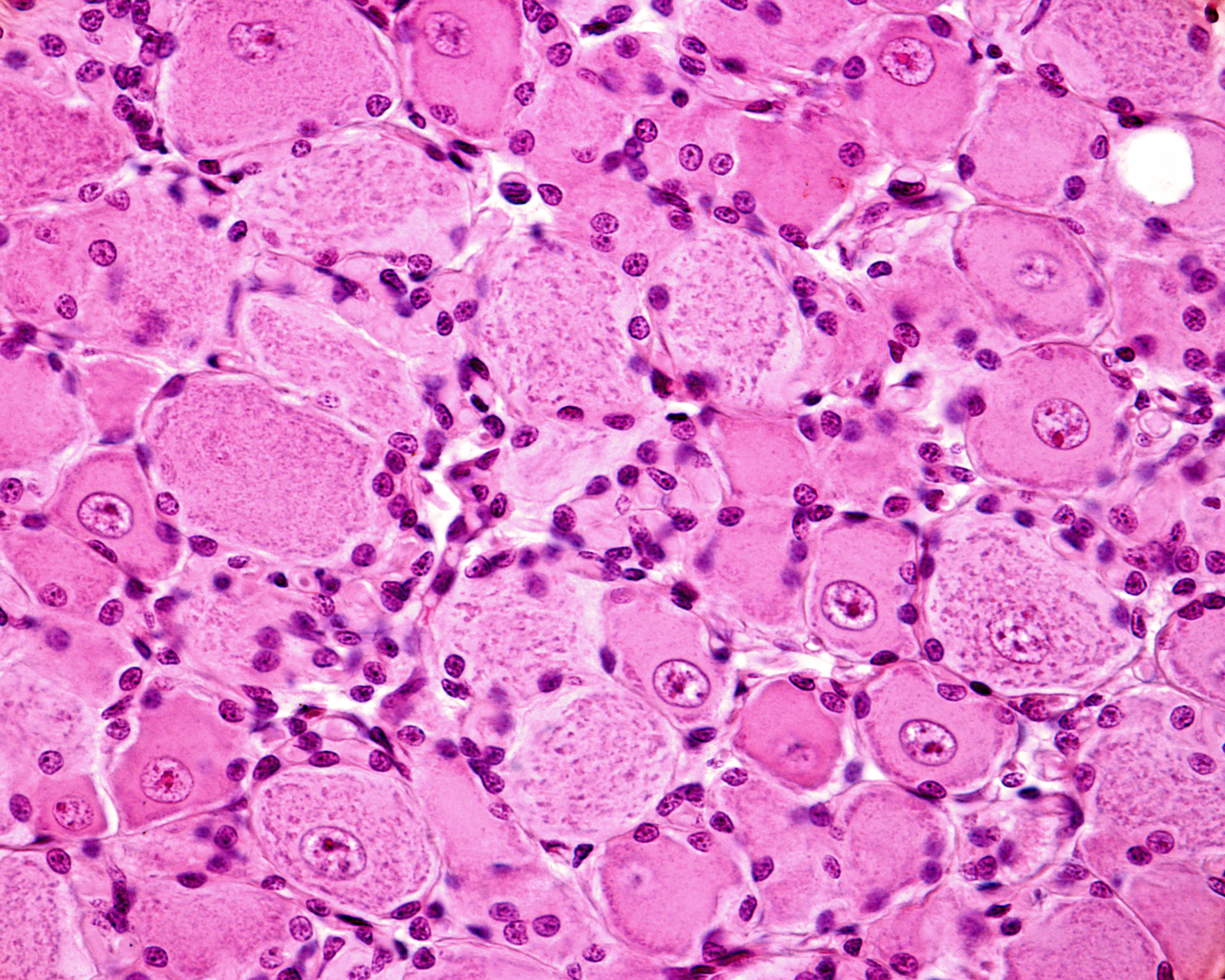 Image of nerve cell bodies in the DRG. 