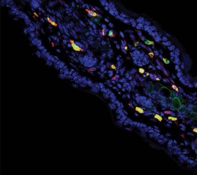 mast cells in the skin (yellow) 