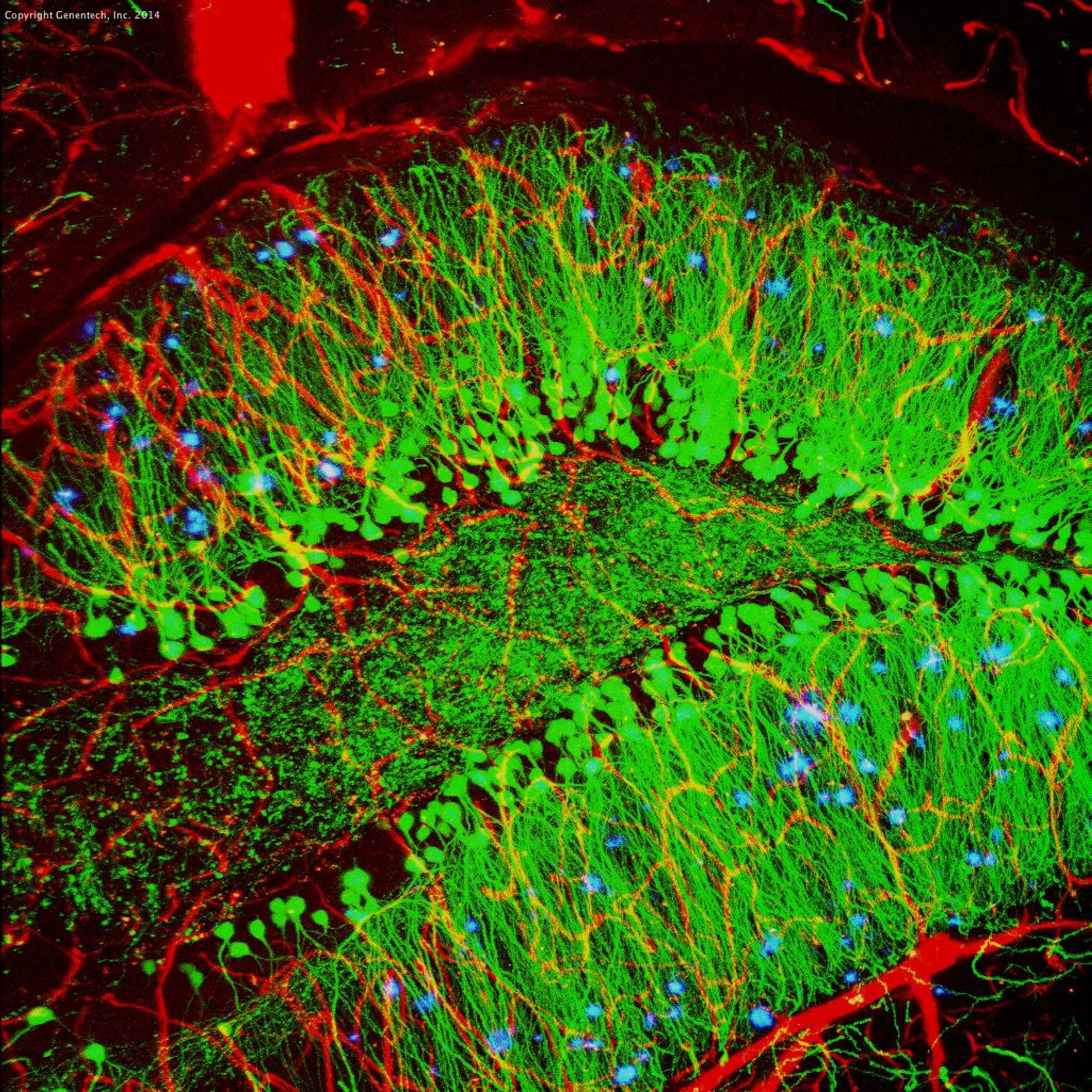 Mouse brain showing hallmarks of Alzheimer’s disease (amyloid plaques in blue) with blood vessels (red) and nerve cells (green). 