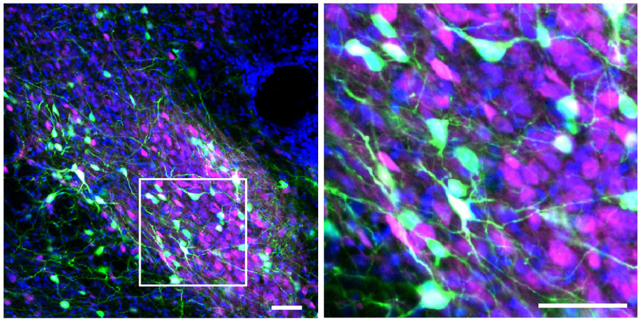 PBN labeled pain neurons2_0.jpg Image of pain-sensing neurons highlighted in green