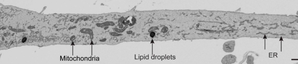 The prehensile protrusion shown above contains functioning organelles, including endoplasmic reticulum (ER) and energy-producing mitochondria, as shown by electron microscopy. 