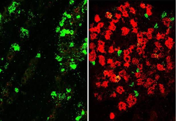 Uninjured trigeminal neurons (left), neurons after injury (right)