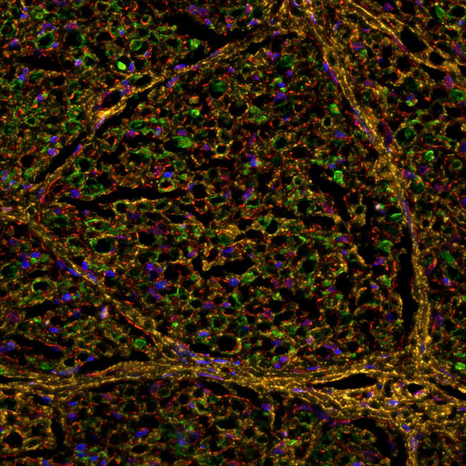 Sprinkled like confetti throughout this image are dozens of green-, yellow-, and red-ringed axons—nerve fibers that transmit electrical signals throughout the nervous system