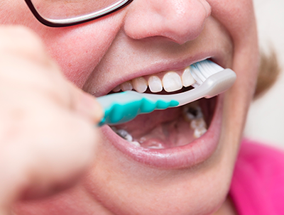 Dental hygiene refers to the practice of maintaining good oral health