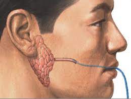 A viral vehicle carrying a corrective gene is infused through a thin tube, or cannula, into a damaged salivary gland.