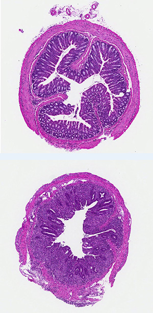 healthy and unhealthy mouse colon tissue