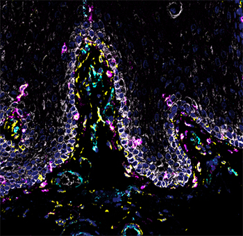 Microscopic view of mucosal cells