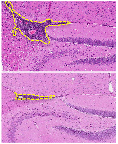 Nerve cells