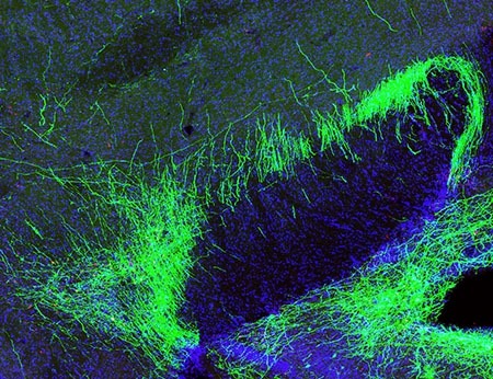 Photo of a group of neurons that blunt pain by sending out projections (green) that suppress activity in multiple pain-processing centers in the mouse brain.