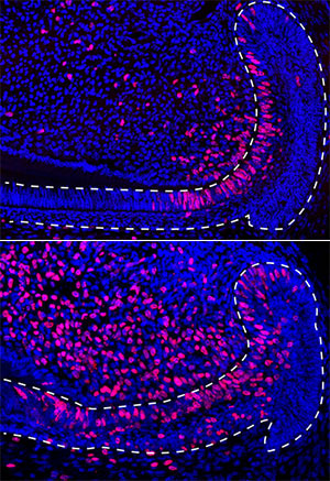 Stem cells (stained pink) in the epithelium of mouse incisors after injury (bottom), compared to undamaged tissue (top).