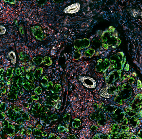 Dr. Blake Warner and his colleagues hope to better understand the biology of healthy human salivary glands, including the workings of the cells (green) within them.