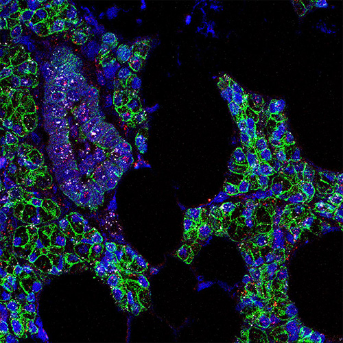 SARS-CoV-2 RNA (pink) was found in human salivary gland cells, which are outlined in green.