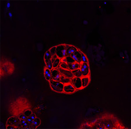 Skeletal stem cells from healthy mice formed clusters of cartilage-producing cells, above, that were later replaced by bone. 