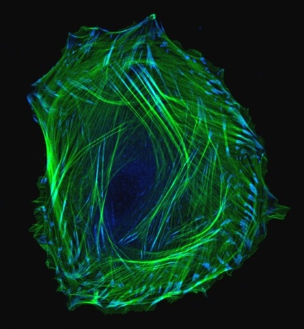 Embryonic smooth muscle cell. Immuno-fluorescently labeled actin cytoskeleton (green) and vinculin in cell adhesions (blue). Laser scanning confocal microscopy.