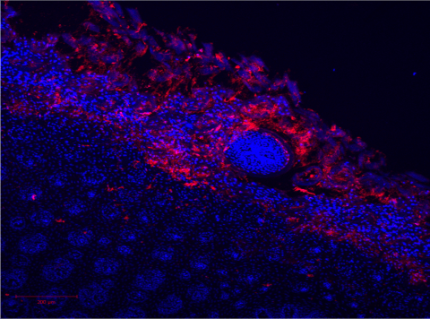 Nano-particles permeating topically into the tongue tissue.