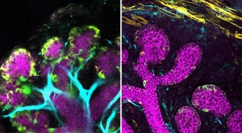 An embryonic mouse submandibular glands and parotid glands.
