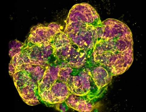 A budding salivary gland