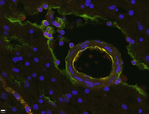 In human brain tissue, scientists found lymphatic vessel cells (green) lining the space surrounding blood vessels, as well as T cells.