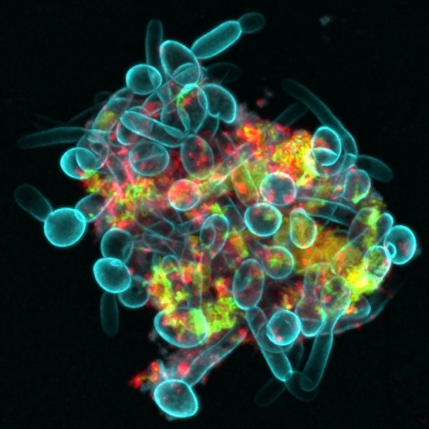 Bacterial-Fungal Clusters in Saliva