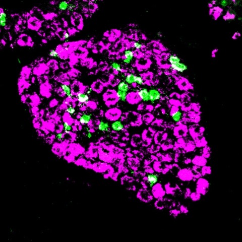 Nerves in dorsal root ganglion.