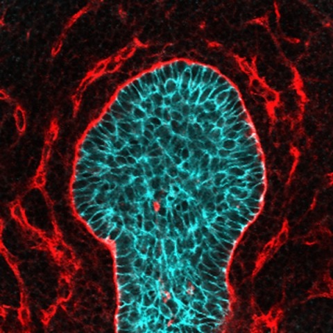 Embryonic submandibular salivary gland.