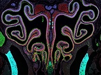 A microscopic view of the mucus-coated sinuses and nasal passages of a mouse.