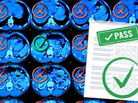 An artificial intelligence model passing a medical quiz.