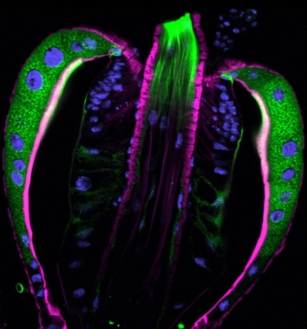 Part of a digestive organ called a proventriculus from a fruit fly larva.