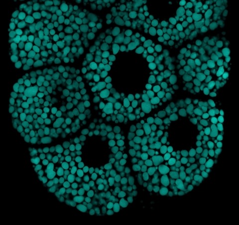Fruit fly salivary gland shows individual cells containing secretory granules.