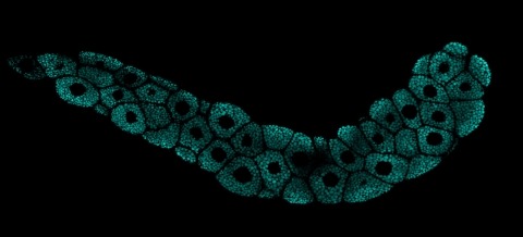 Cells in fruit fly salivary glands are filled with cellular packets known as secretory granules