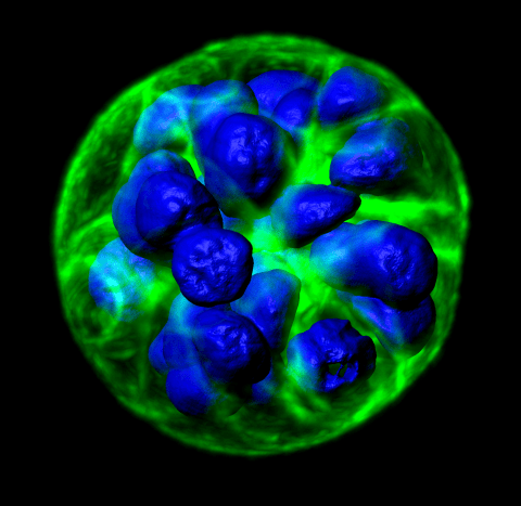 Human salivary stem cells cultured from parotid glands