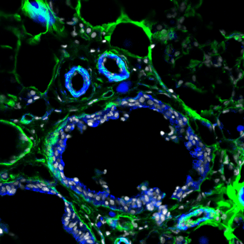 Human parotid glands