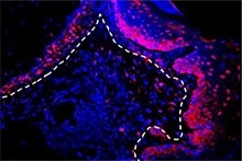 Cytokine IL-23 (pink/red) is barely detectible in gingival (gum) epithelial cells (above the dotted line denotes epithelium) from mice exposed to healthy mouth bacteria (left), whereas it’s highly abundant in cells from mice exposed to the kinds of mouth bacteria found in periodontal disease (right). IL-23 instigates inflammation when the mouth’s microbial communities are out of balance. 