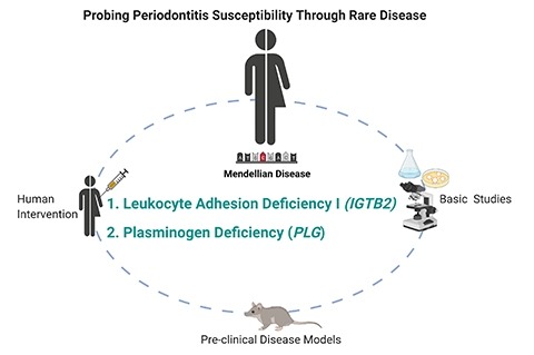 Probing Periodontitis Susceptibility Through Rare Disease diagram