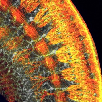 Cross section of mouse embryo torso.