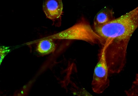 Oral pathogen P.gingivalis invasion of human gum cells