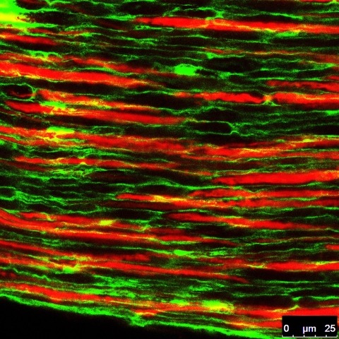 Sensory nerve of the mouse incisor.