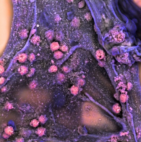 Scanning electron micrograph of mesenchymal stem cells cultured in an alginate hydrogel.