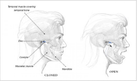 Tmj Range Of Motion Chart