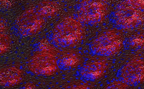 Taste buds on the tongue with permeated red labelled nano-particles.