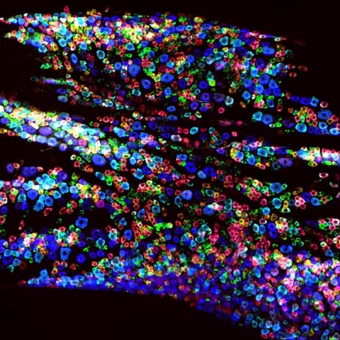 Trigeminal ganglion nerves