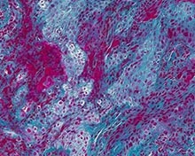 Blood clotting 