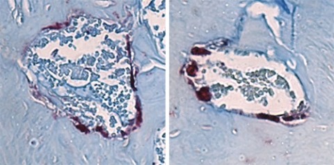 Bone-degrading cells (maroon) in the jawbone marrow of mice lacking microbes (left) are smaller in size than those from mice with a single type of gut microbe (right) that is associated with bone loss from the jaw. 
