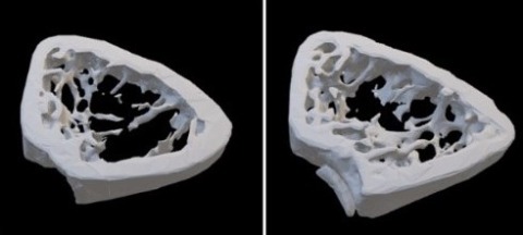 Comparison of LRAP levels in the bone of mice.